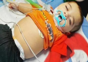 سرگودھا: 5 سالہ بچے کے معدے سے چابی نکال لی گئی، ڈاکٹرز کو خراج تحسین
