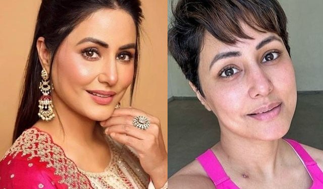 میں نے ان نشانات کو پیار سے گلے لگایا یہ میری جیت کی نشانی ہیں