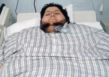 طبی معجزہ، سعودی شہری نے 542کلو وزن کم کر لیا، موجودہ وزن 63.5 کلو