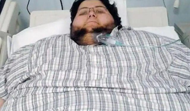 طبی معجزہ، سعودی شہری نے 542کلو وزن کم کر لیا، موجودہ وزن 63.5 کلو
