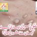 منکی پاکس کی بیماری کب اور کہاں سے شروع ہوئی؟