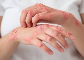 خاموش وباء کا خطرہ، سائنسدانوں کی وارننگ