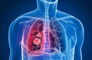 کبھی تمباکو نوشی نہ کرنے والوں میں پھیپھڑوں کے کینسر کا خطرہ، نئی تحقیق